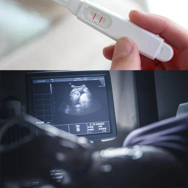 Is mifepristone safe for abortion ? Is mifepristone safe for abortion ?